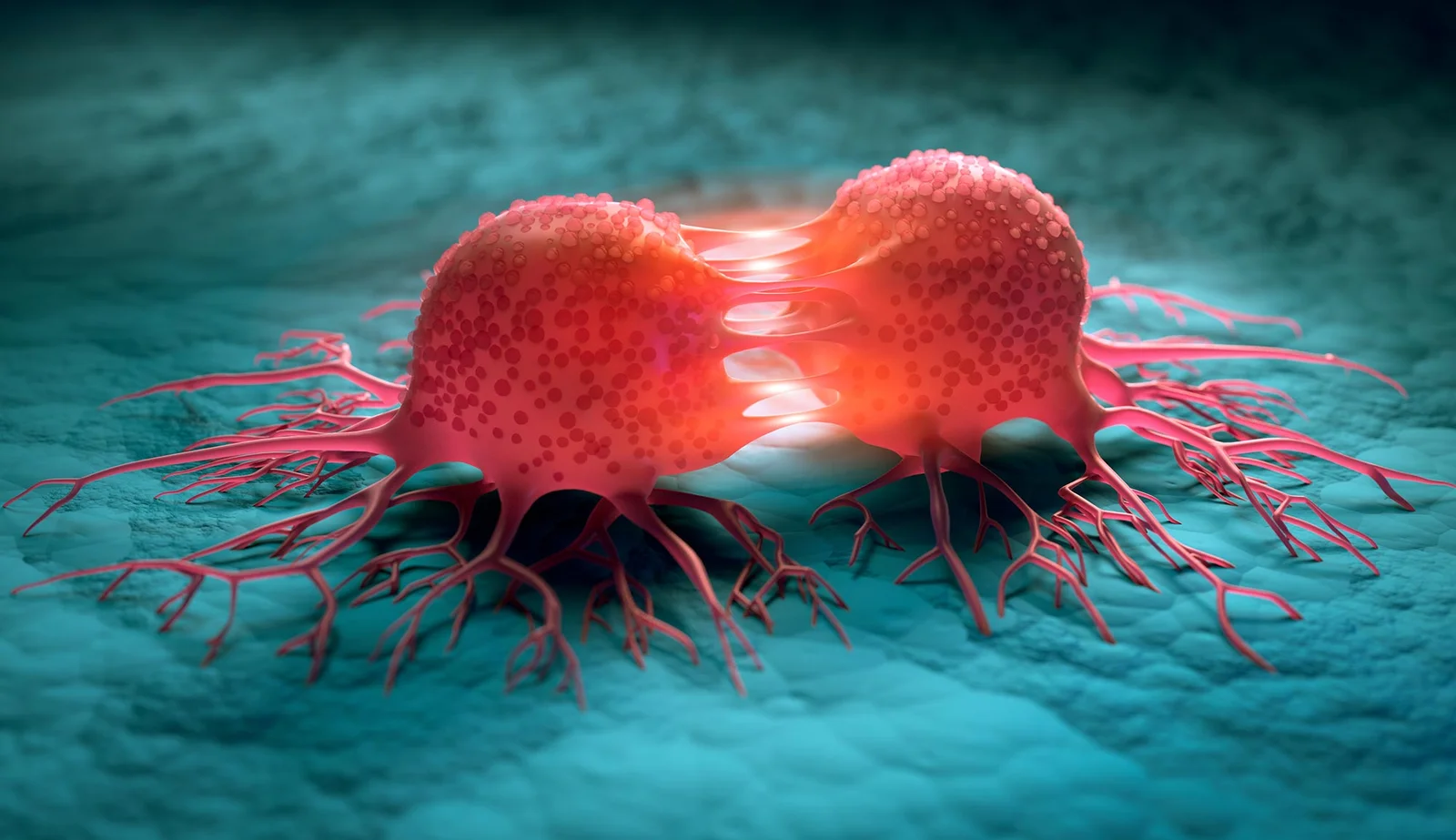 Fat Type Determines Pancreatic Cancer Growth, Study Finds