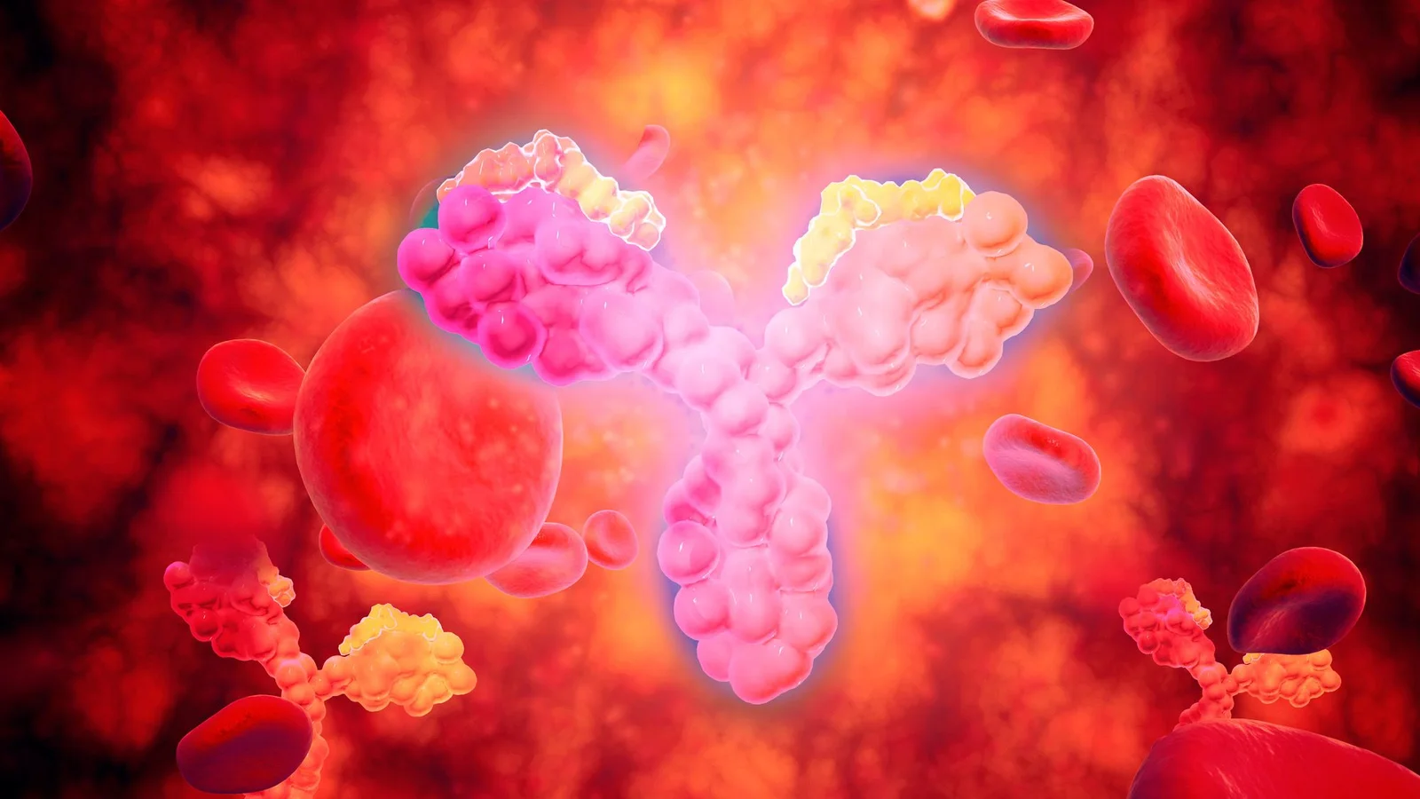 IL-10 Autoantibodies May Drive Inflammatory Bowel Disease in a Subset of Patients