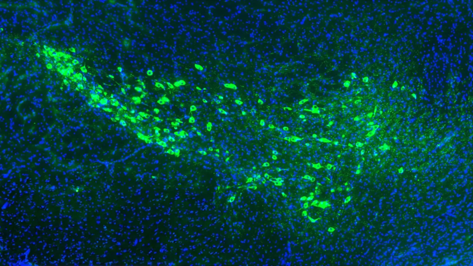 Two neuron surface proteins may drive Parkinson's spread; blocking them slows disease in mice