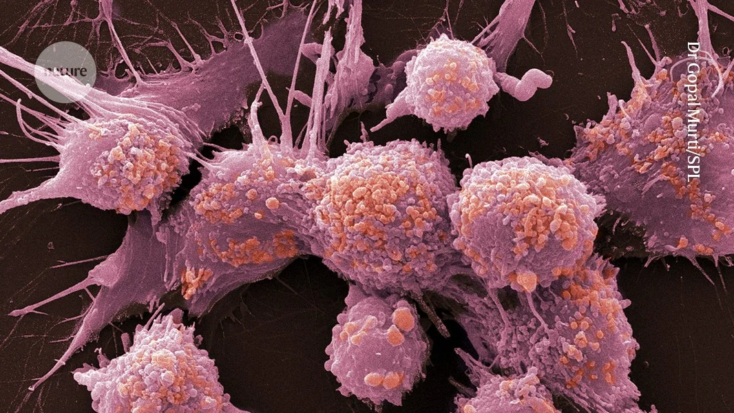 New PSA screening data hint at mortality benefit, but gains remain modest