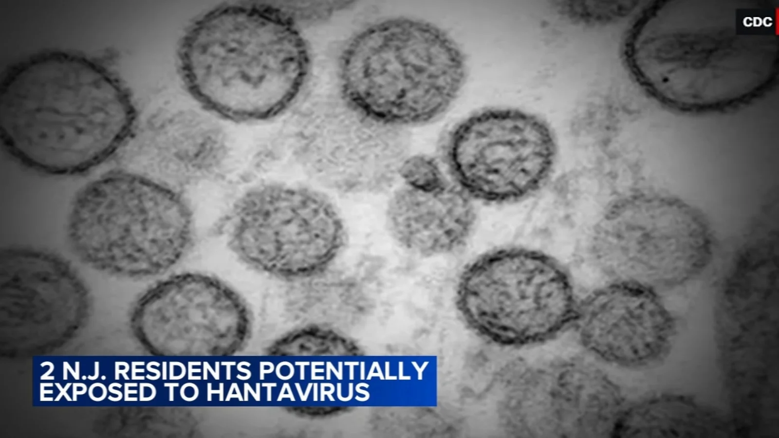 New Jersey residents watched for hantavirus after exposure linked to MV Hondius
