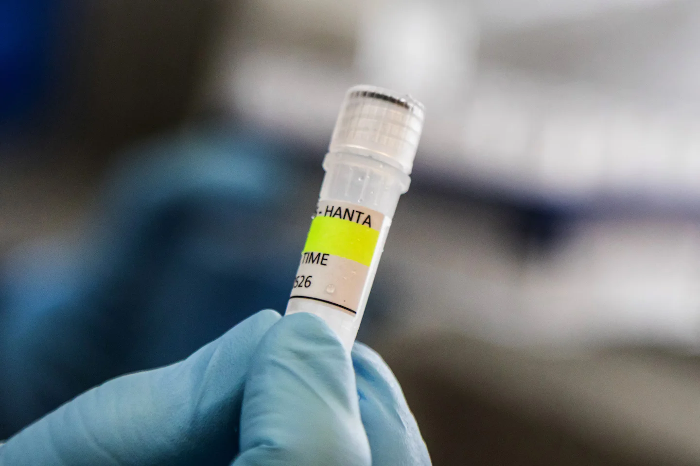 Why the hantavirus quarantine lasts six weeks