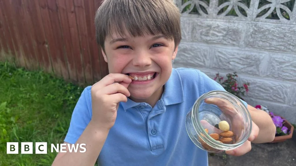Cardiff boy with 20 allergies pursues US-based treatment to live more normally