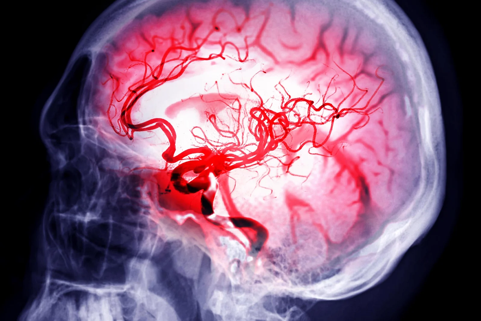 Circadian Clock Therapies Boost Stroke Recovery by Enhancing Brain Waste Clearance in Mice