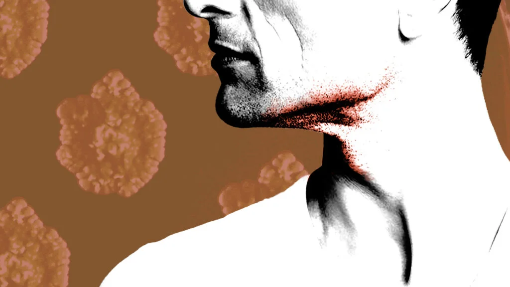 Rare livestock bacterium linked to mild skin infections in European MSM networks