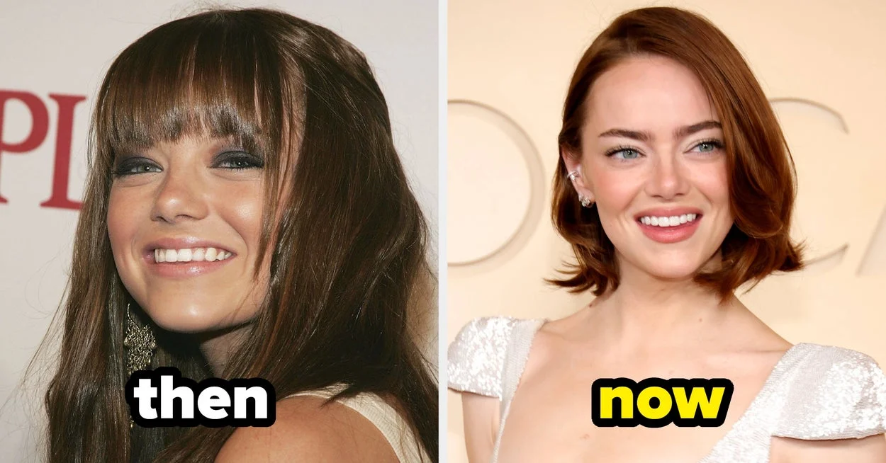 Then and Now: Celebrities' Transformations After Fame
