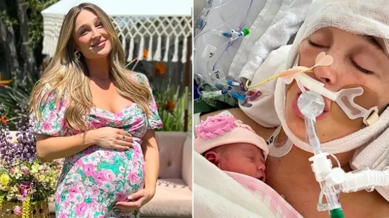 Influencer Jackie Miller James in Coma Due to Aneurysm