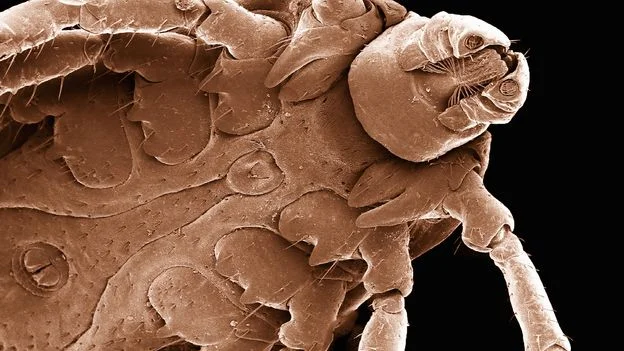 From Dog Ticks to Human Vaccines: A Growing Push to Prevent Lyme Disease