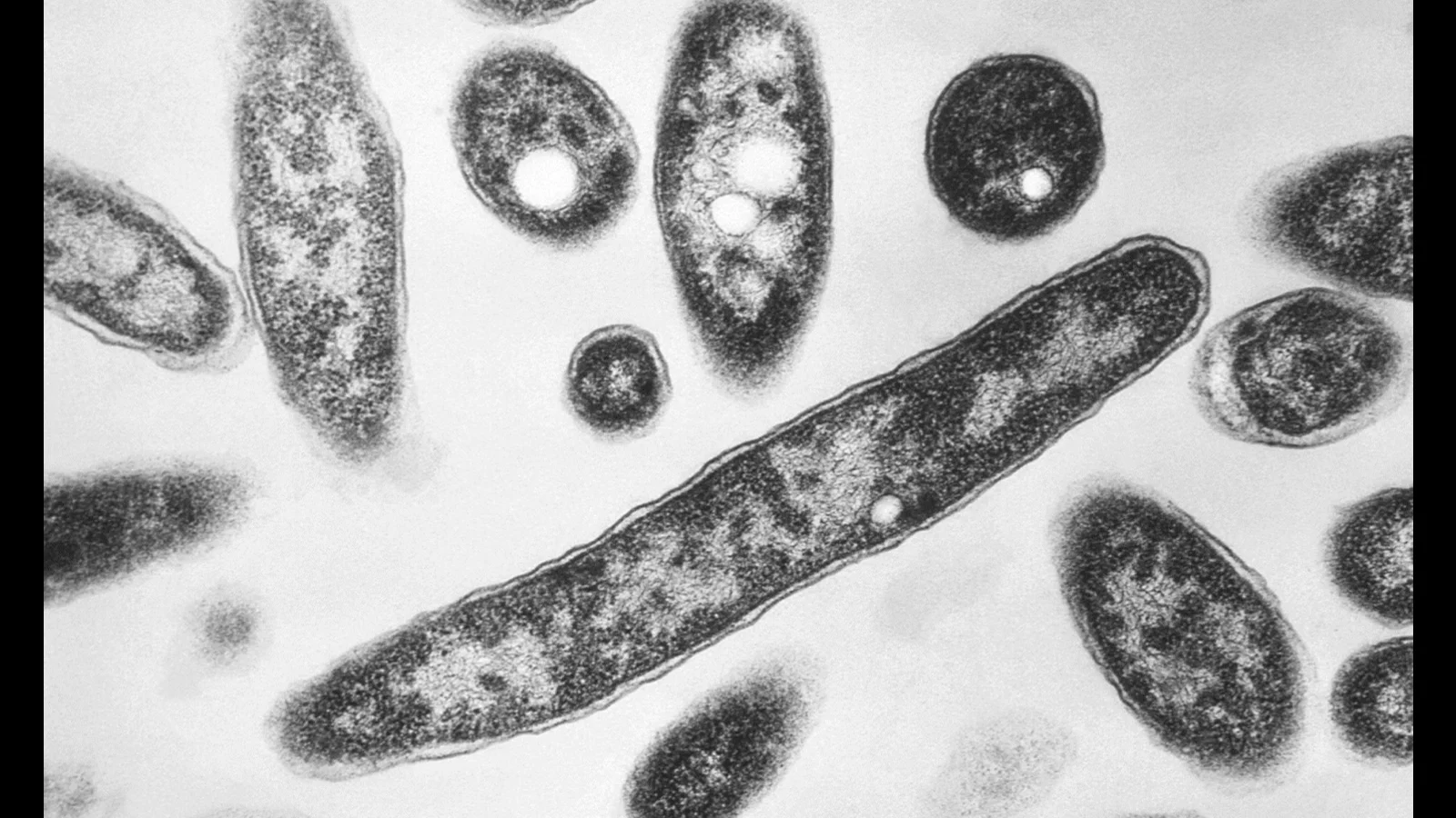 NC confronts rising Legionnaires' disease; here's how to stay safe