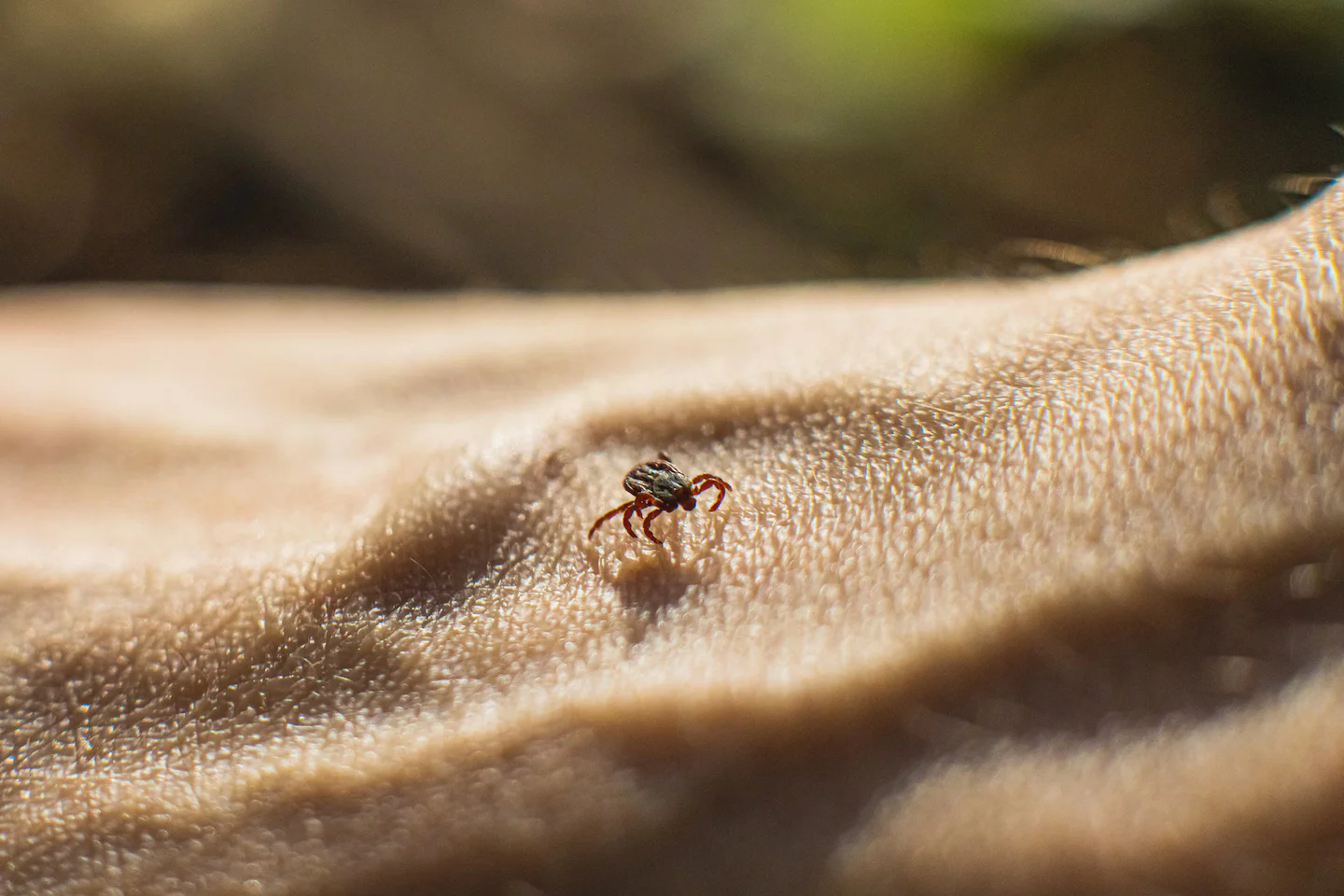 Powassan virus: rising tick-borne threat as US tick season lengthens