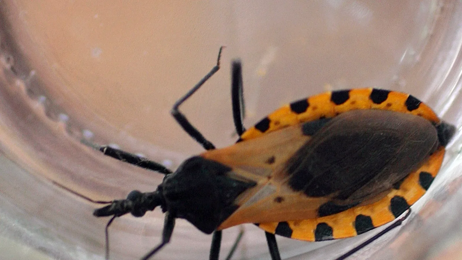 San Diego County Detects First Local Case of Chagas Disease