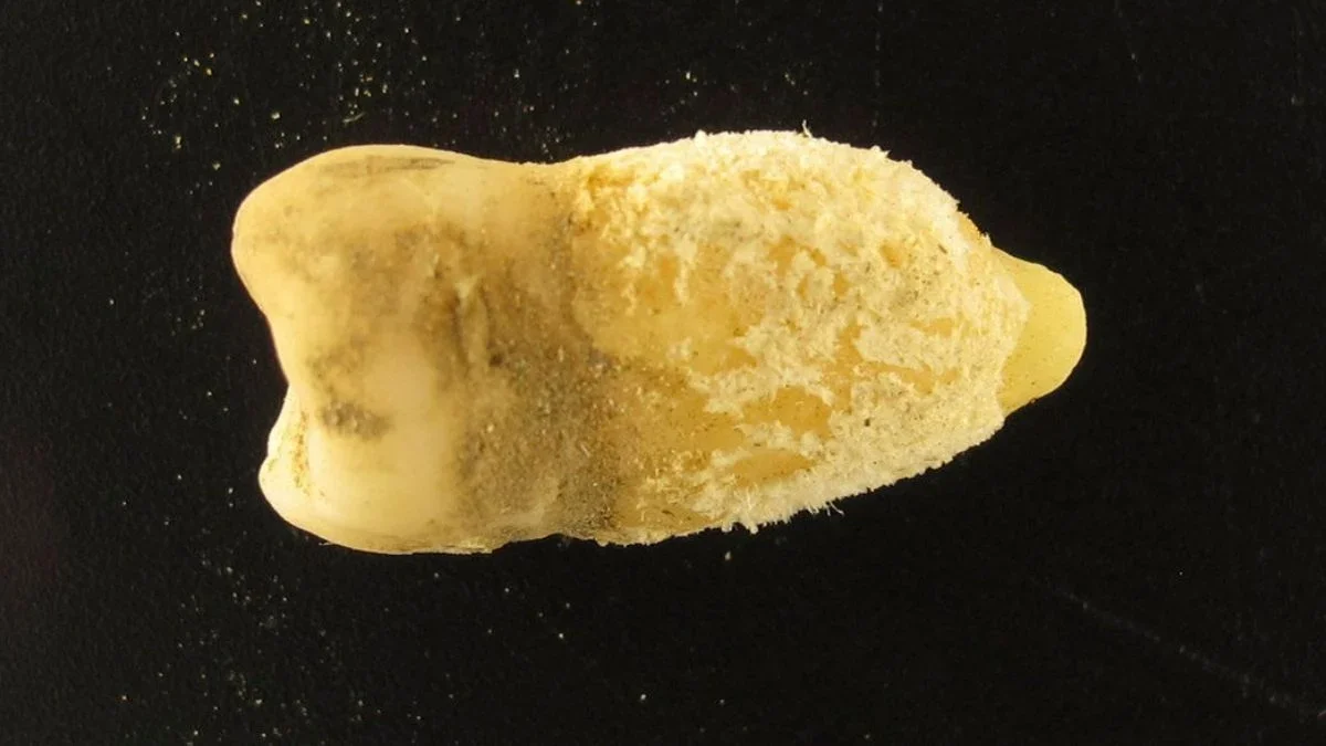 Ancient Bolivian Tooth Rewrites Scarlet Fever Timeline