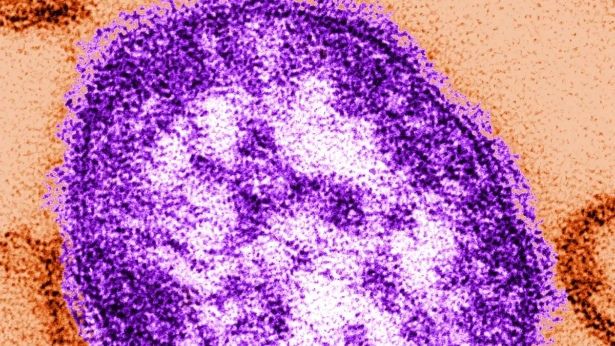 Measles Resurgence: First Case in Illinois Since 2019 Confirmed