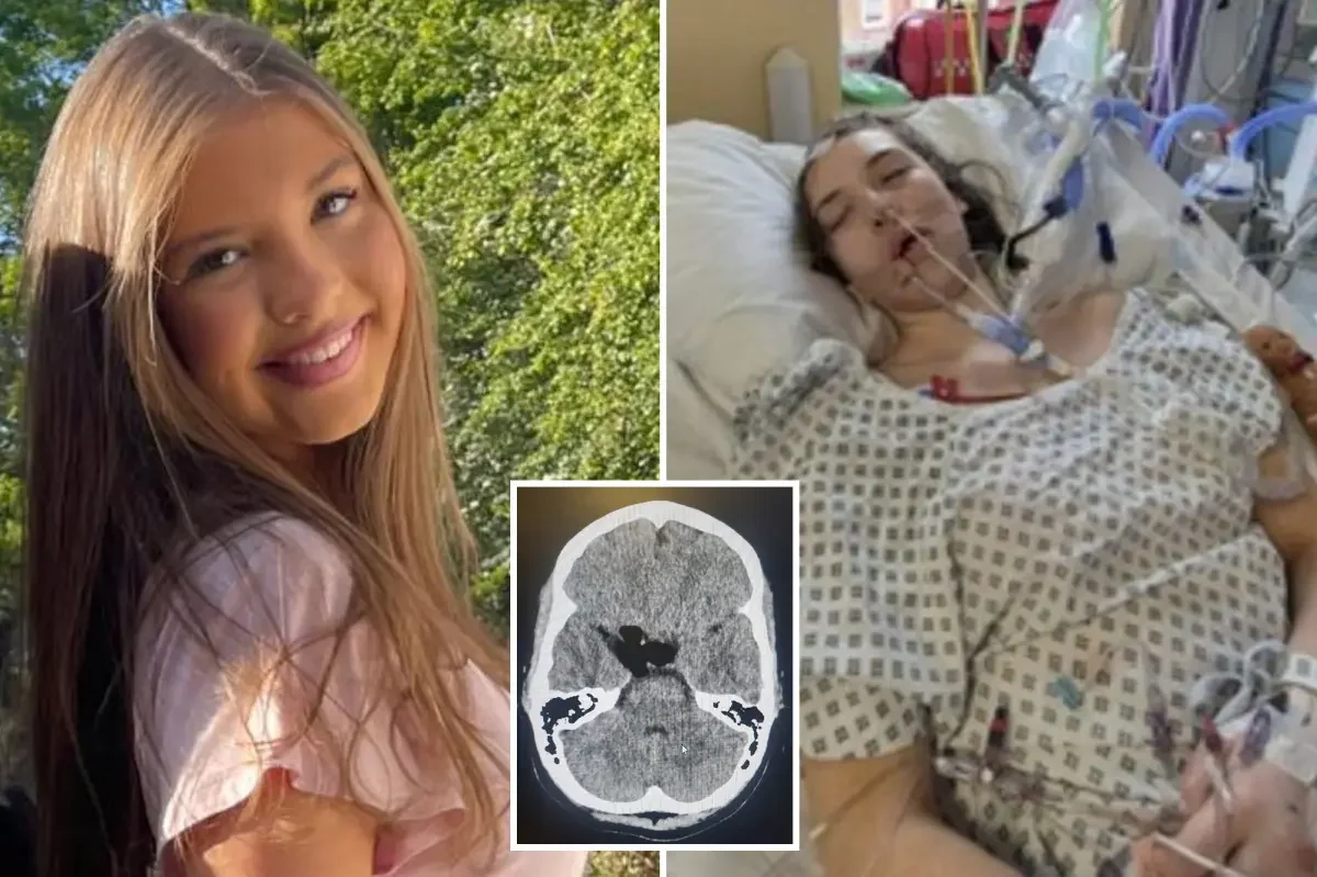 Heatwave headaches hid a ruptured brain tumor in a teen