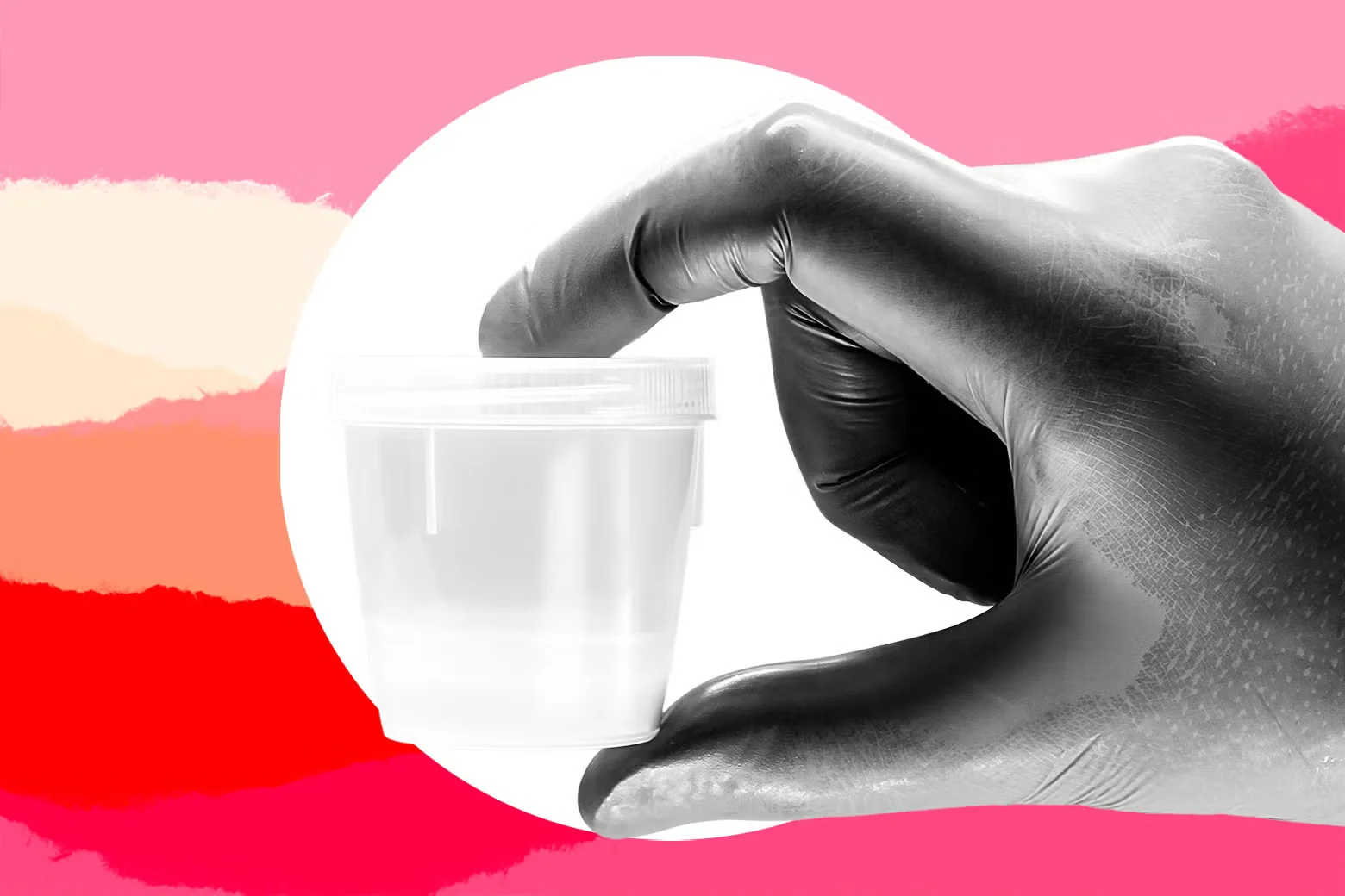Donor Sperm Dilemma Tests a Marriage’s Plan for Parenthood