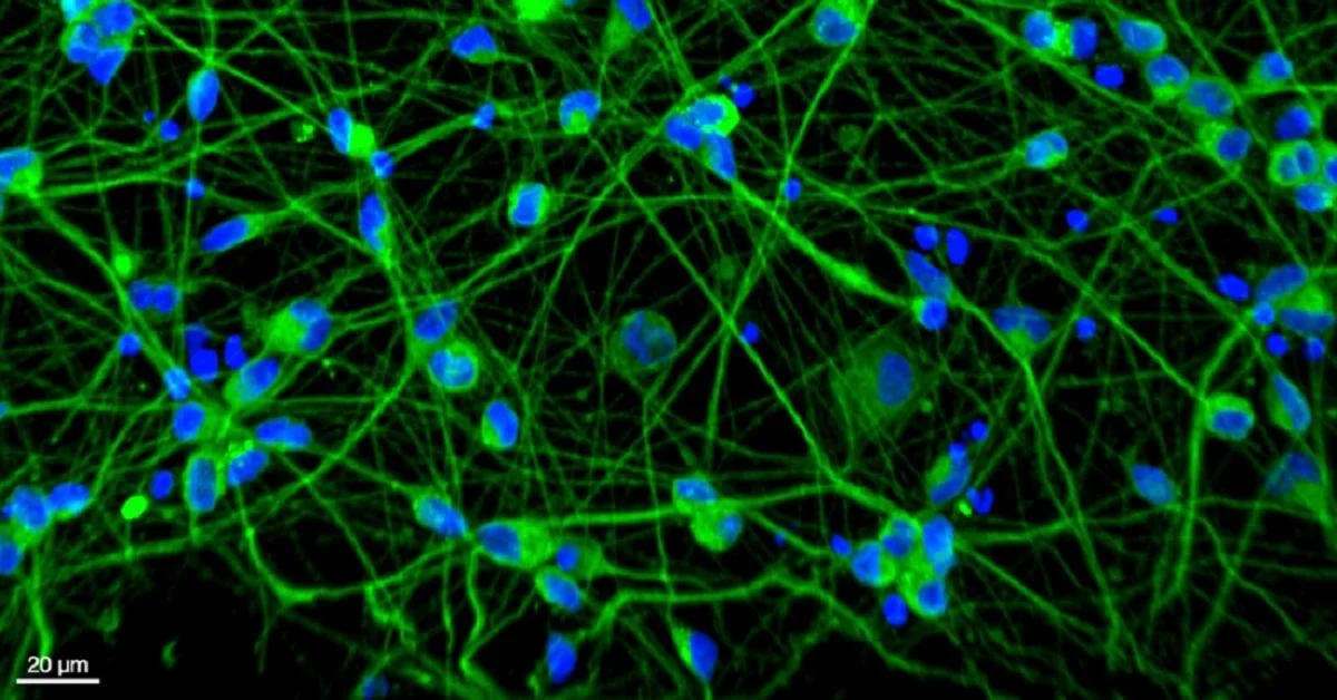 Scientists Aim to Clean Up RNA Pollution to Halt Neurodegeneration