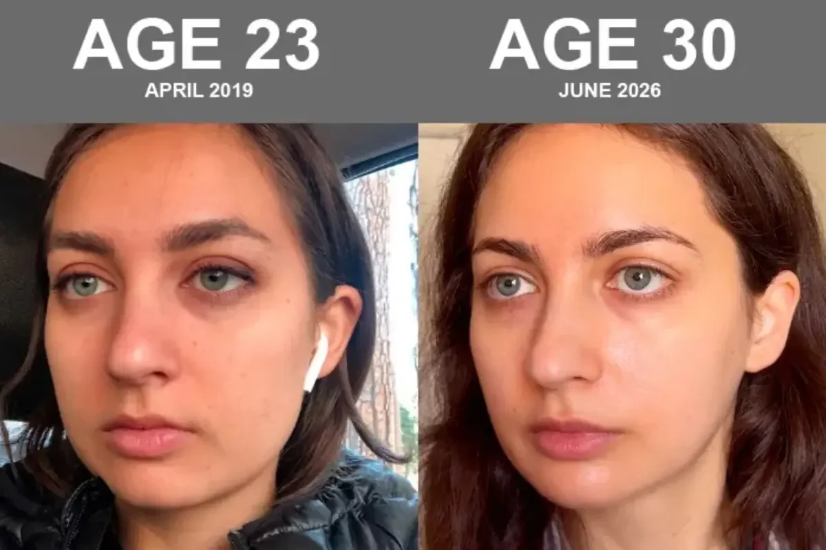 Biohacking girlfriend claims skin age is 21 at 30 after science-led regimen