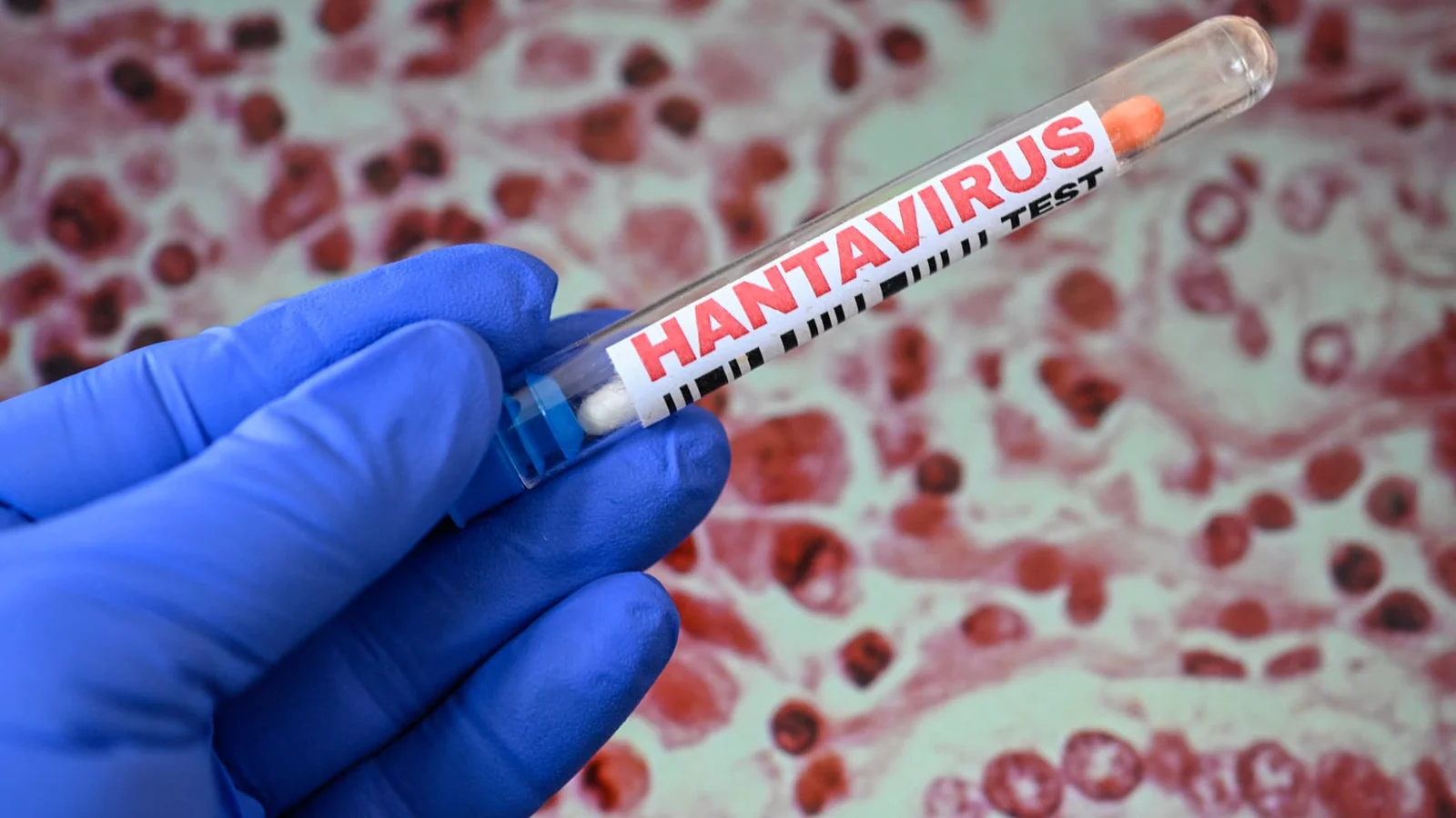 Hantavirus Outbreak Triggers Cautious Biotech Stock Rally
