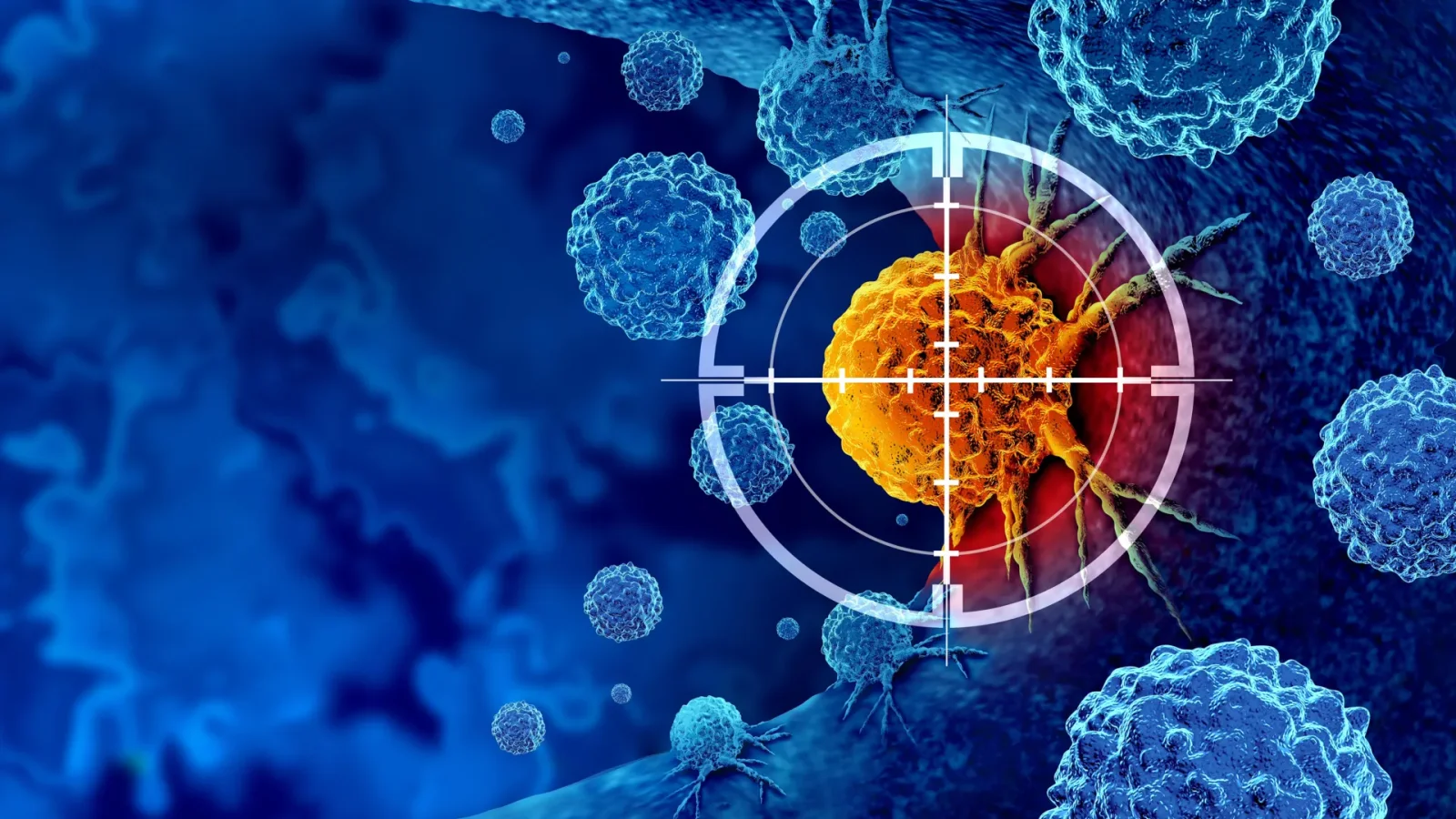 RNA-targeting CRISPR revives immune visibility of prostate cancer