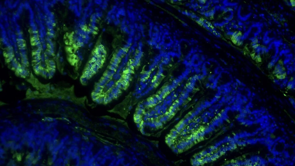 Oral lac-phe pill aims to mimic exercise, preserving muscle during weight loss in early trials