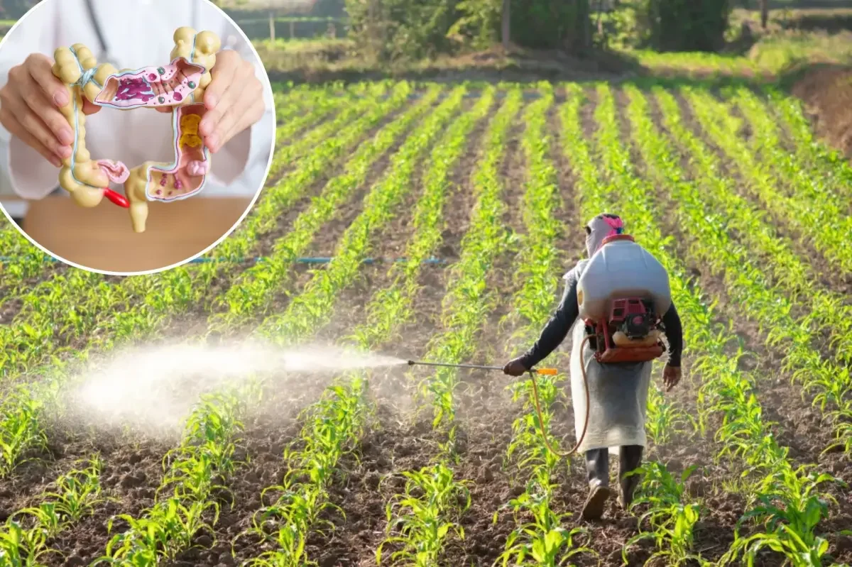 Pesticide exposure tied to rise in early-onset colorectal cancer, study suggests